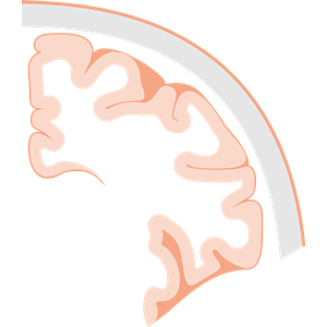 Brain Coronal Slice
