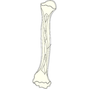 Bone 003